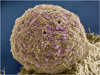 hiv_infected_cells 1
